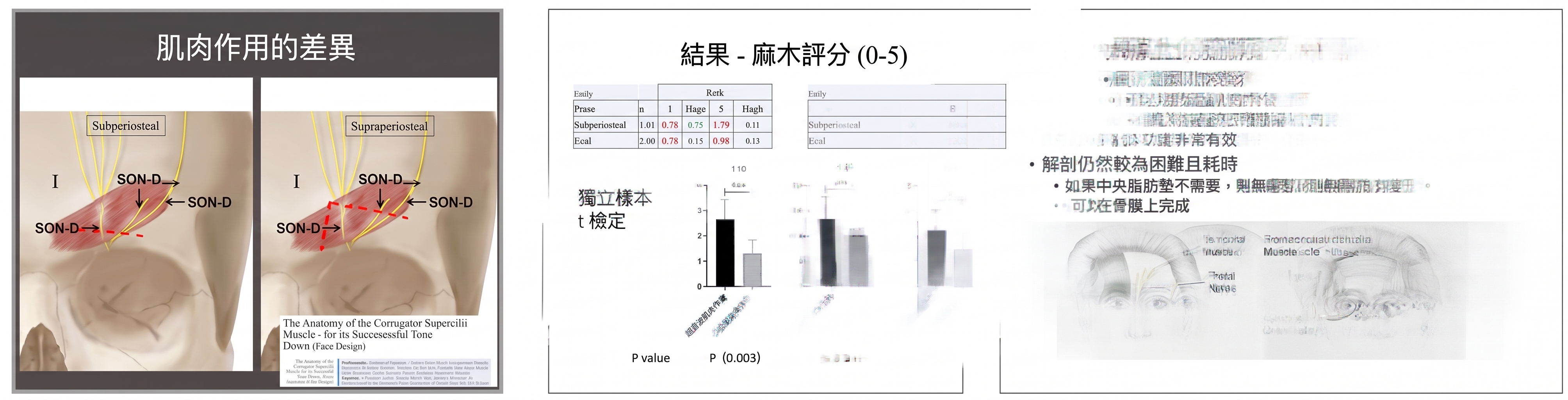 額頭拉皮・提眉手術，只是把眉毛拉高就夠了嗎？手術層次與保護神經的核心關鍵 | Taylor整形外科 사진 2