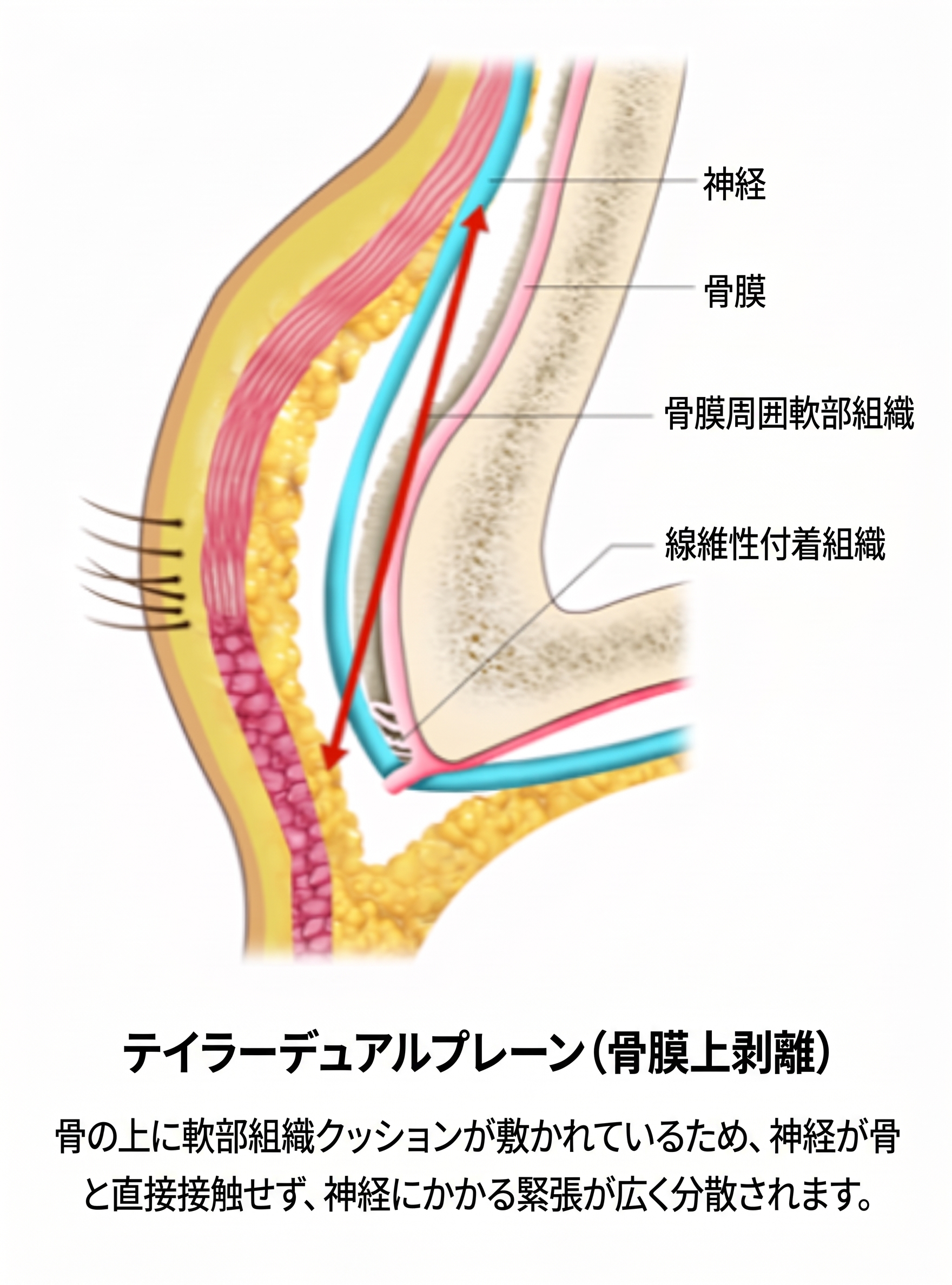 額リフト・眉下垂改善、眉毛を引き上げるだけで十分でしょうか?手術層と神経保護の重要ポイント | テイラー美容外科 사진 6