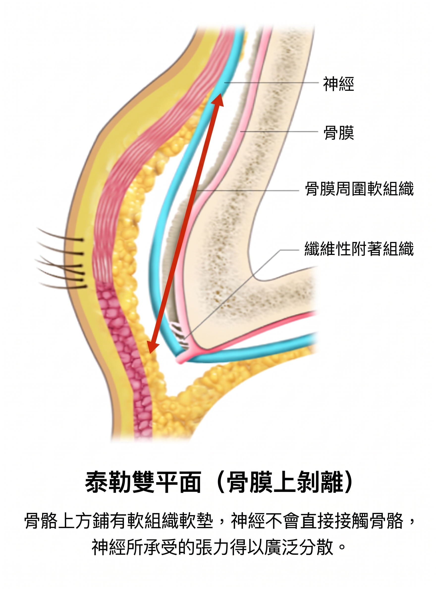 額頭拉皮・提眉手術，只是把眉毛拉高就夠了嗎？手術層次與保護神經的核心關鍵 | Taylor整形外科 사진 6