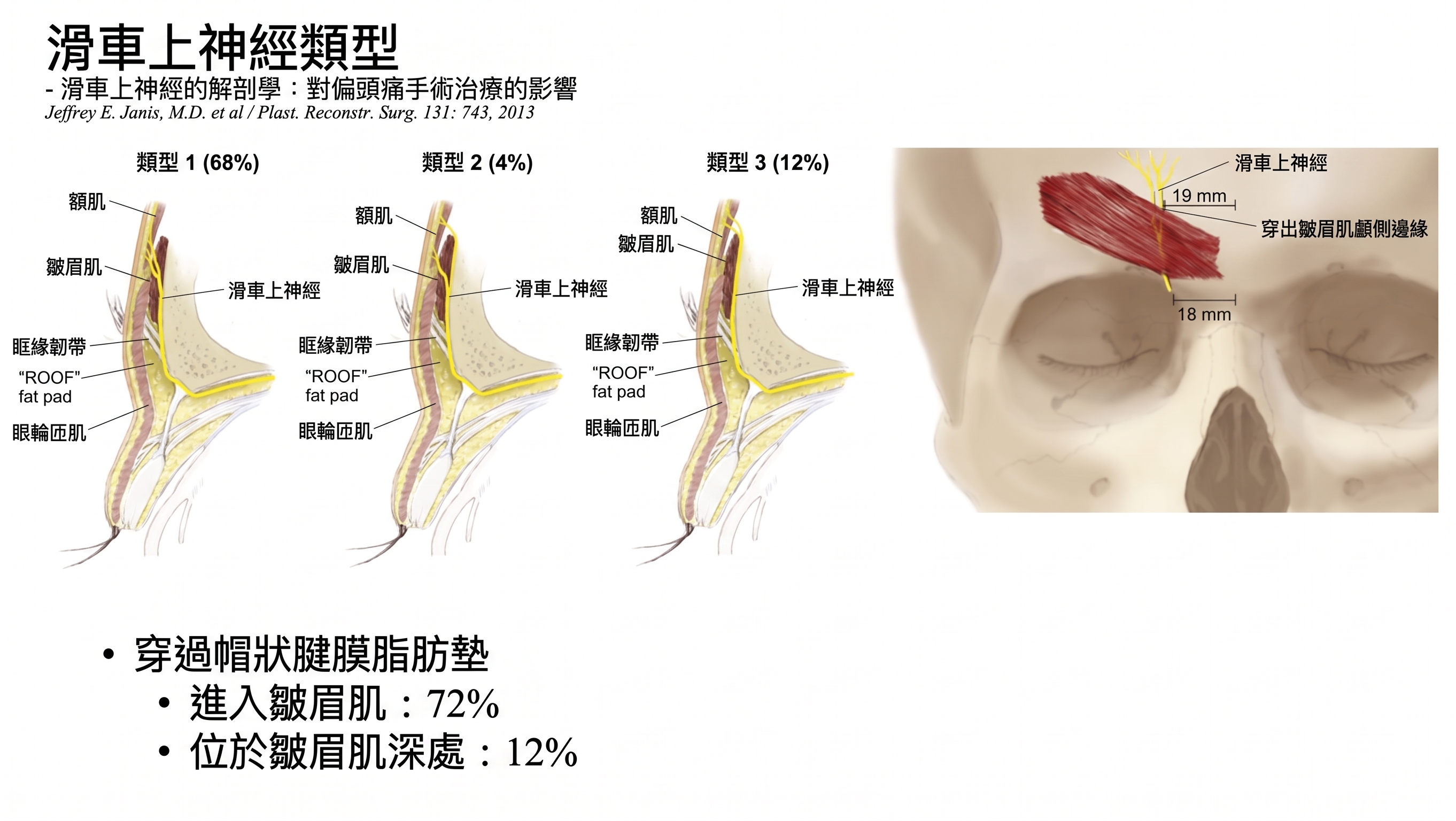 減少前額拉皮副作用的雙平面手術法 — 內視鏡前額拉皮臨床研究結果公開 | Taylor 整形外科 사진 4