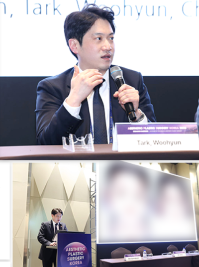 이마거상 부작용을 줄이는 듀얼플레인 수술법 — 내시경이마거상 임상 연구 결과 공개 | 테일러성형외과 사진 7