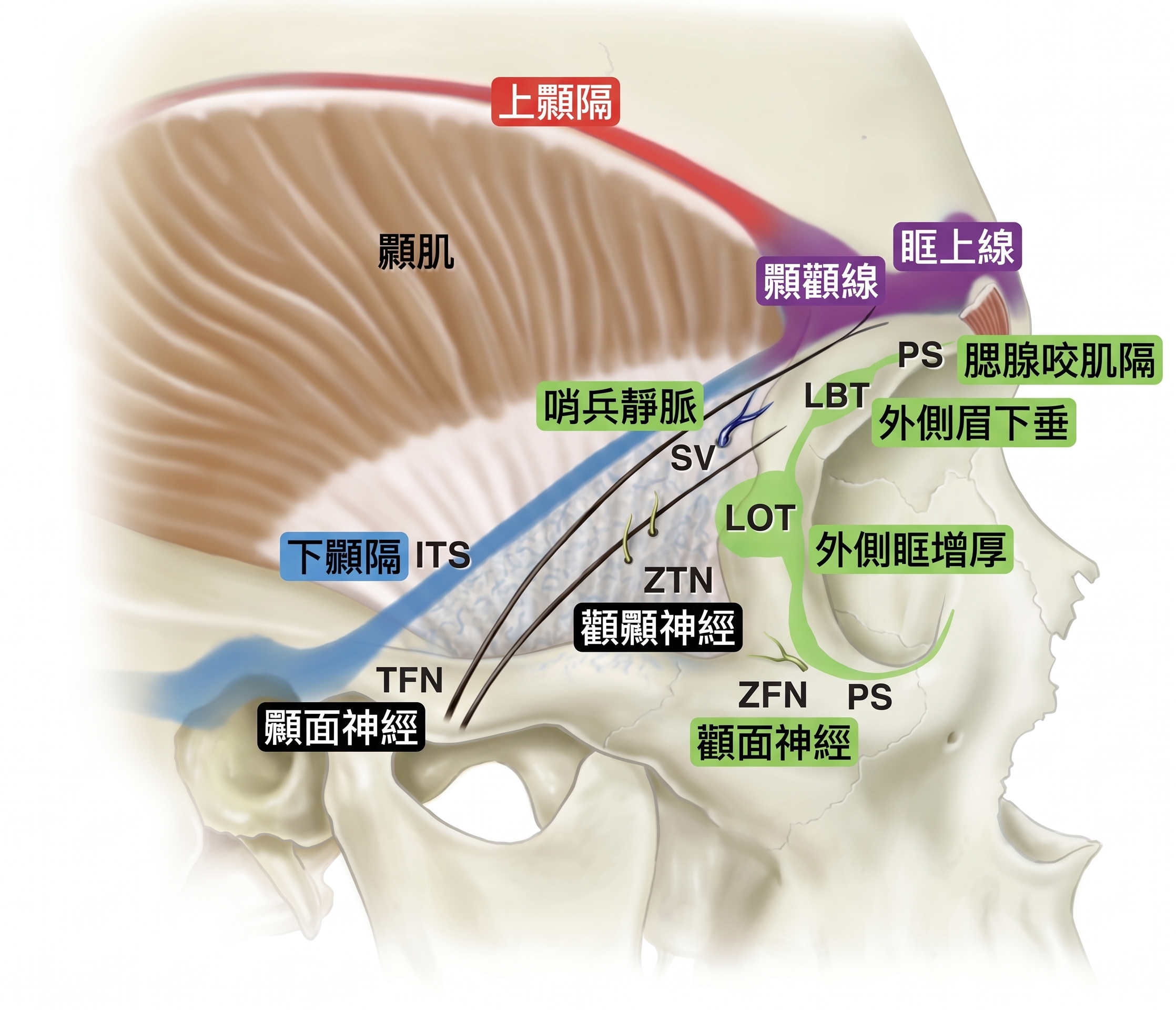 內視鏡前額拉皮剝離範圍應該到哪裡?從肌肉、神經到固定方式,深入解析前額拉皮核心關鍵 | Taylor整形外科 사진 4
