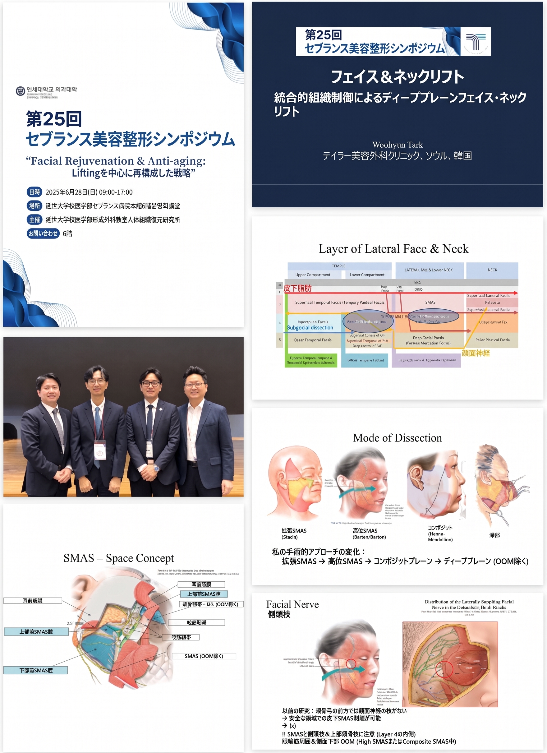 切開リフト、皮膚だけを引き上げる手術ではありません — ディーププレーン切開リフトの核心原理 | テイラー美容外科 사진 2