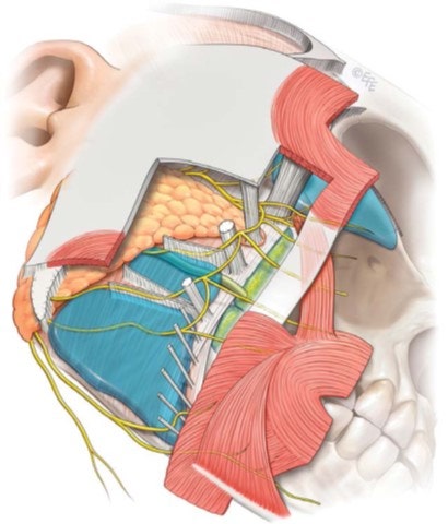 안면거상술에서 SMAS 외에 무엇을 함께 봐야 하는가 - Integrated Tissue Control | 테일러성형외과 사진 5